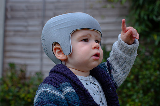 Why Head Shape Matters: How Early Intervention Can Help Prevent Plagiocephaly